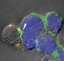 Lymphocytes