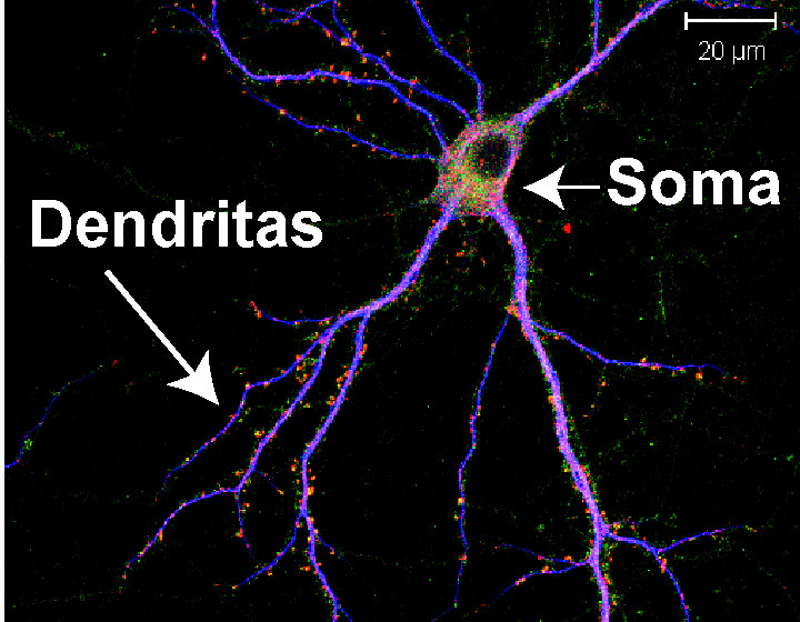 Neurona