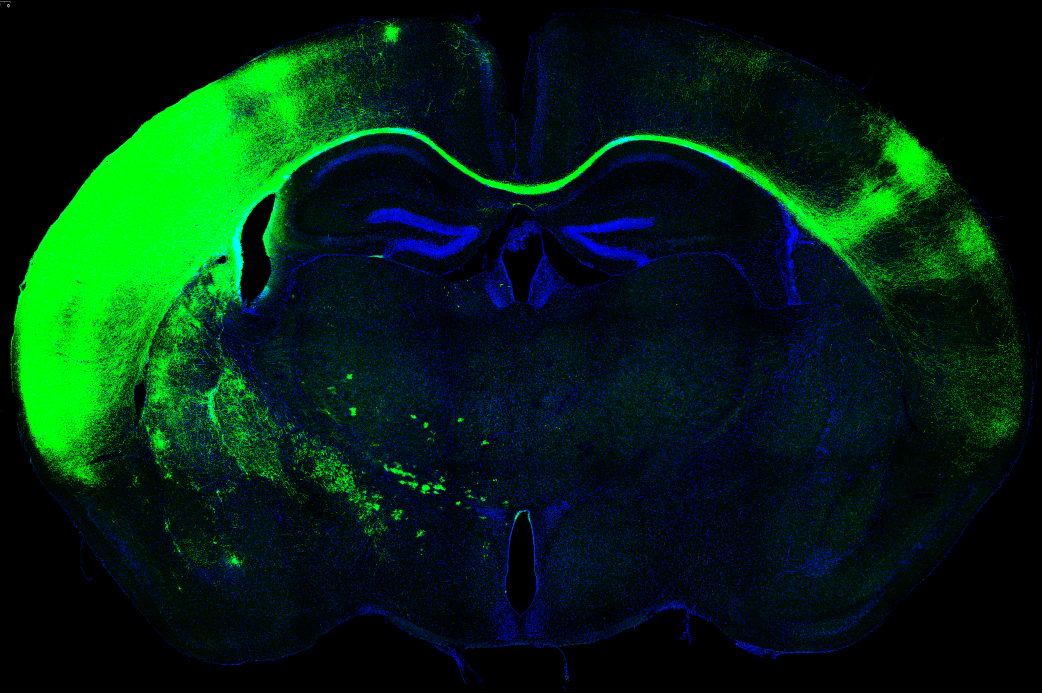 MouseBrain CorpusCallosum MartaNieto