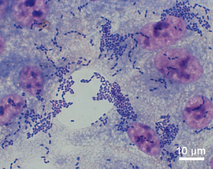 Escherichia coli