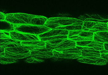 Citoesqueleto de actina en los hipocotilos de Arabidopsis