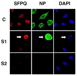 PLoS Pathog 7(11): e1002397