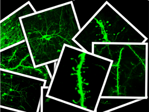 Colección de imágenes de dendritas teñidas con proteína verde fluorescente
