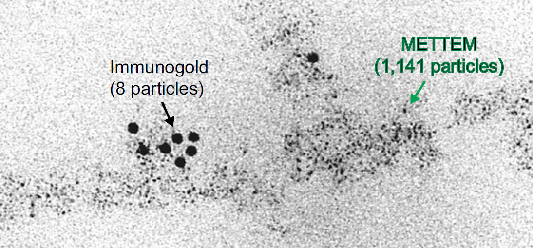 Detección de proteínas por microscopía electrónica