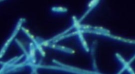 Pseudomonas aeruginosa