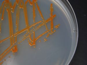 Polaribacter MED152 es una de las bacterias que utiliza la rodopsinas para utilizar la energía de la luz