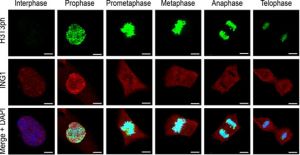 Células en diferentes fases del ciclo cellular con marcaje   en diferentes colores de las histonas modificadas y el ADN