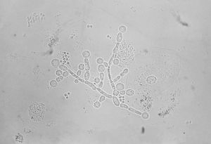 Candida albicans al microscopio