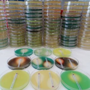 Ensayo de sensibilidad a antibióticos en diferentes mutantes de Pseudomonas aeruginosa resistentes a diferentes antibióticos crecidos en placas de cultivo individualmente. En cada placa se observa un halo de inhibición del crecimiento bacteriano causado por el antibiótico presente en cada tira (E-Test). 