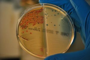 Bacterias resistentes a los antibióticos aisladas en el IRYCIS. 