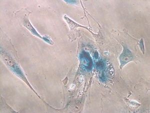 Imagen de microscopía de células senescentes. 