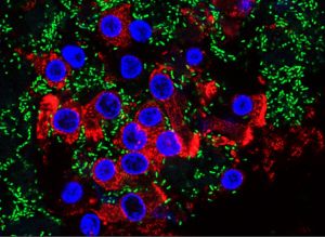 Infección de células pulmonares por la bacteria Pseudomonas aeruginosa. 