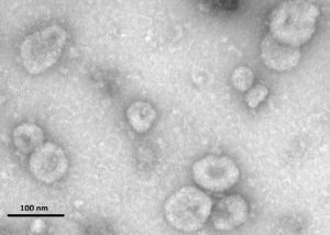 Un nuevo método es capaz de detectar nanovesículas en cantidades mínimas de orina
