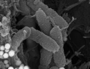 La bacteria Pseudomonas aeruginosa vista al microscopio. 