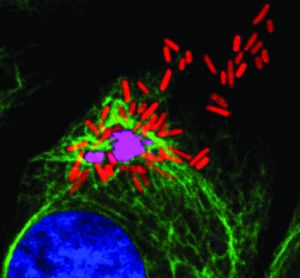 Célula infectada por Salmonella. En rojo bacterias de Salmonella, en morado agregados de membranas, en verde vimentina rodeando el agresoma y en azul núcleo de la célula.