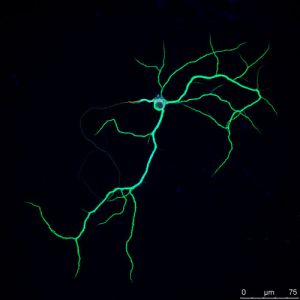 Neurona