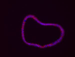 Organoide de colon generado a partir de tumores de ratón 