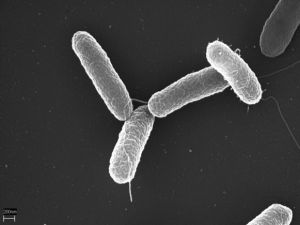 Imagen al microscopio de Salmonella enterica serovar Typhimurium. 
