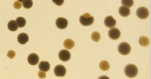 Colonias de la bacteria ‘Klebsiella pneumoniae’ con cambios en su morfología debido a genes que saltan desde plásmidos al cromosoma bacteriano. 